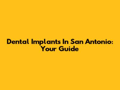 Dental Implants In San Antonio: Your Guide