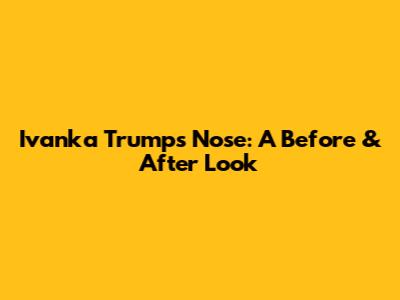 Ivanka Trump's Nose: A Before & After Look