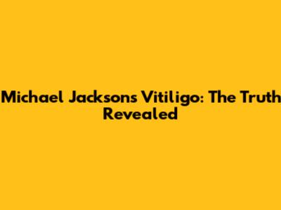 Michael Jackson's Vitiligo: The Truth Revealed