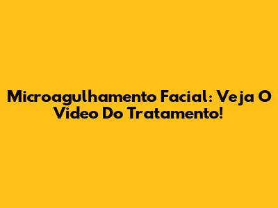 Microagulhamento Facial: Veja O Video Do Tratamento!