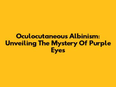 Oculocutaneous Albinism: Unveiling The Mystery Of Purple Eyes
