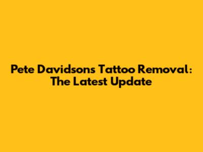 Pete Davidson's Tattoo Removal: The Latest Update