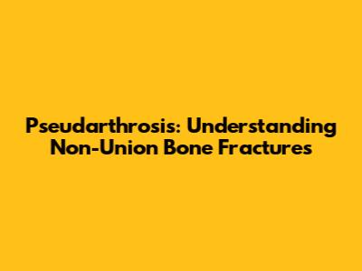 Pseudarthrosis: Understanding Non-Union Bone Fractures