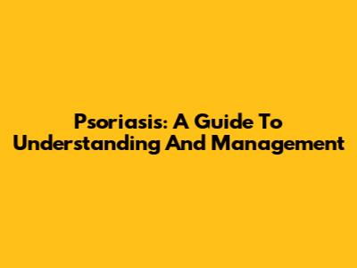 Psoriasis: A Guide To Understanding And Management
