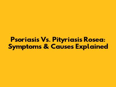 Psoriasis Vs. Pityriasis Rosea: Symptoms & Causes Explained