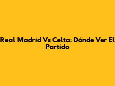 Real Madrid Vs Celta: Dónde Ver El Partido