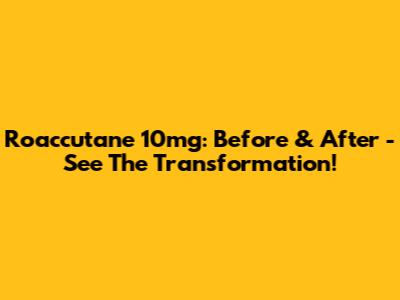 Roaccutane 10mg: Before & After - See The Transformation!